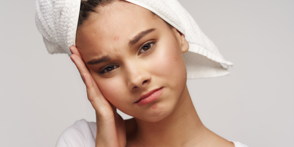 The Ultimate Guide to Preventing Acne and Visible Pores