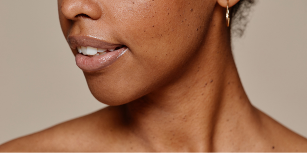 Get Rid of Uneven Skin Tone: Clear Solutions