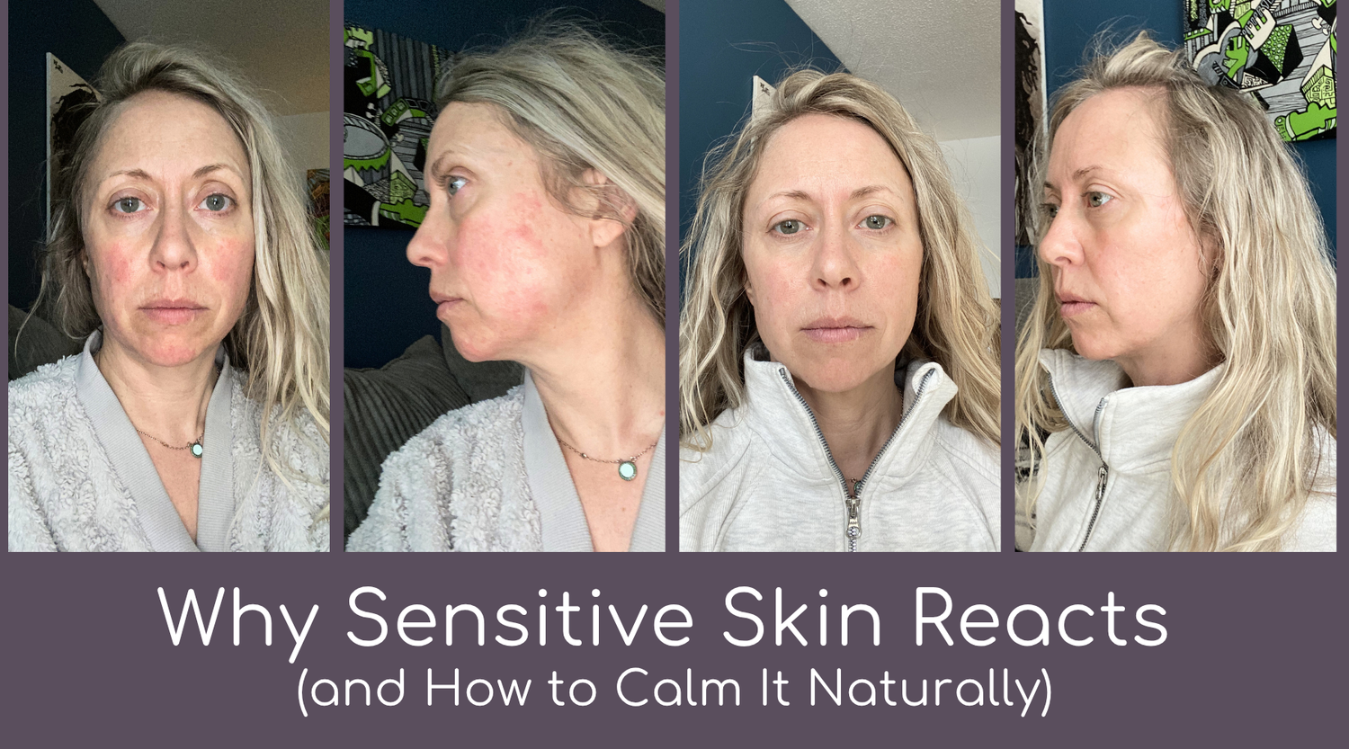 Why Sensitive Skin Reacts (and How to Calm It Naturally)