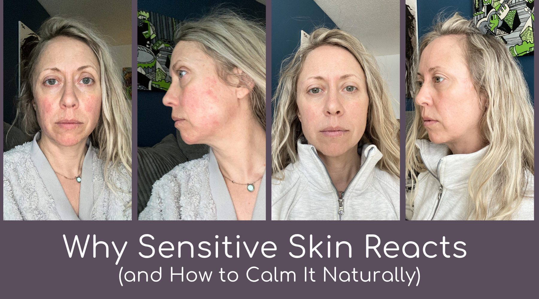 Why Sensitive Skin Reacts (and How to Calm It Naturally)